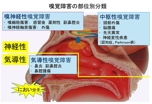 嗅覚障害の部位別分類